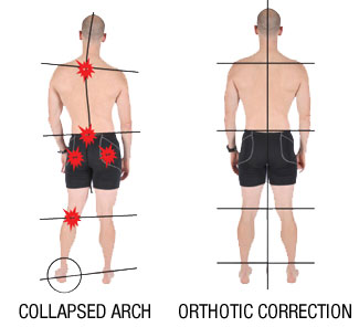 runners-knee-pain-causes